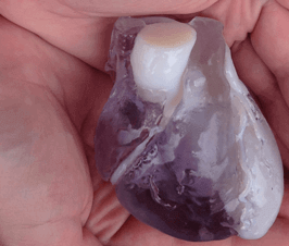 3d-printing-in-healthcare